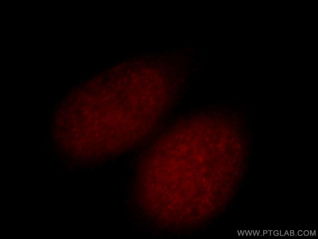 GLYR1 Antibody in Immunocytochemistry (ICC/IF)