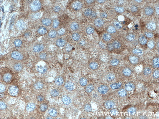 FABP7 Antibody in Immunohistochemistry (Paraffin) (IHC (P))