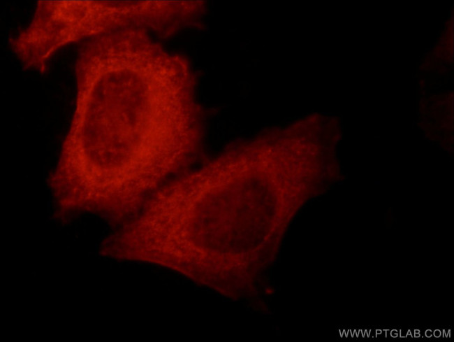 KLHL14 Antibody in Immunocytochemistry (ICC/IF)
