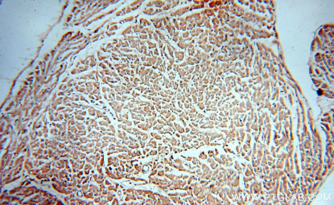 Collagen Type VI Antibody in Immunohistochemistry (Paraffin) (IHC (P))