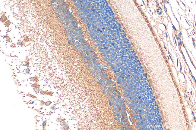 RD3 Antibody in Immunohistochemistry (Paraffin) (IHC (P))