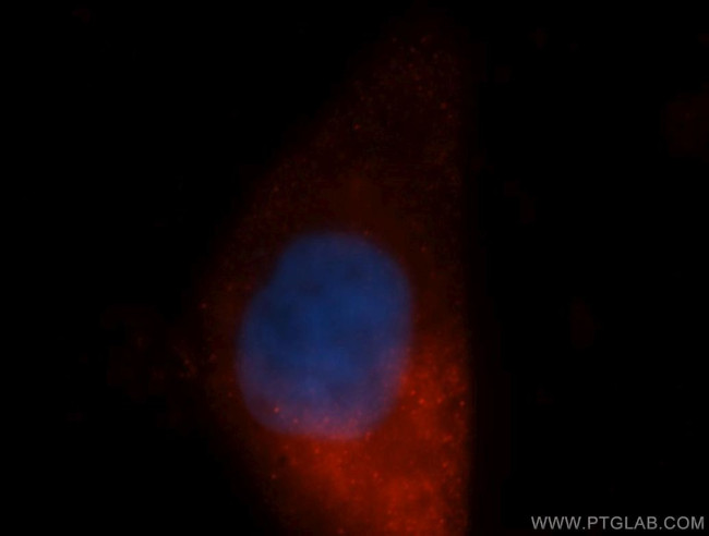 LMP7 Antibody in Immunocytochemistry (ICC/IF)