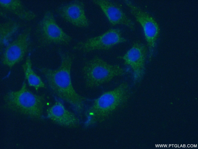 AKTIP Antibody in Immunocytochemistry (ICC/IF)