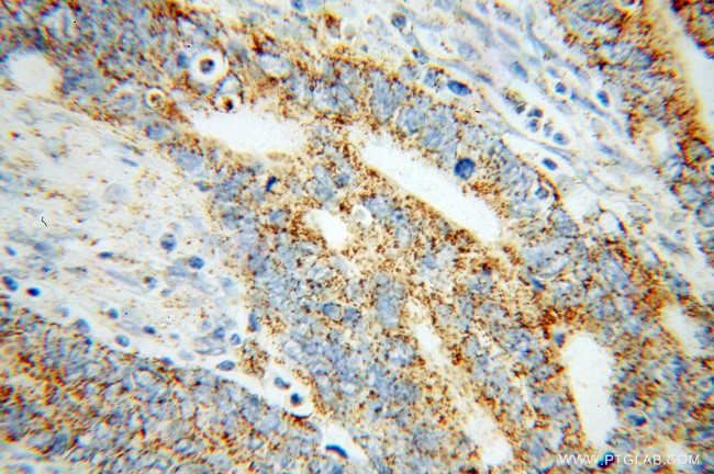 MCCC1 Antibody in Immunohistochemistry (Paraffin) (IHC (P))