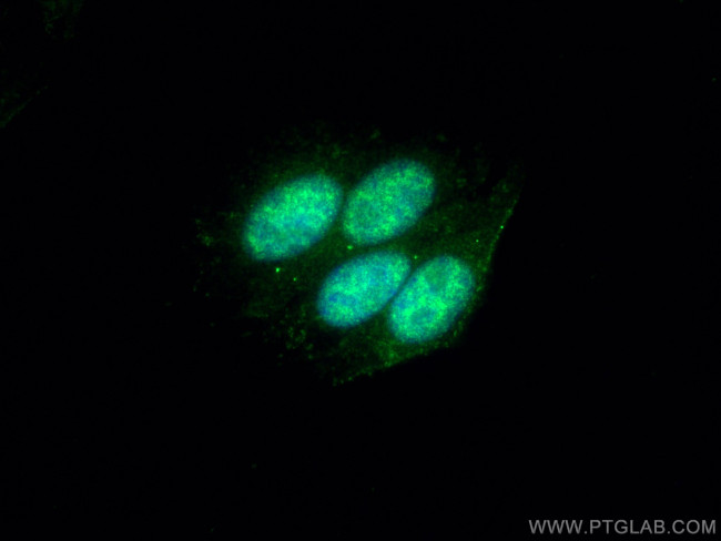 THOC5 Antibody in Immunocytochemistry (ICC/IF)
