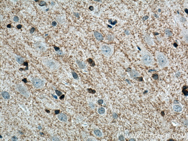 Plasmolipin Antibody in Immunohistochemistry (Paraffin) (IHC (P))