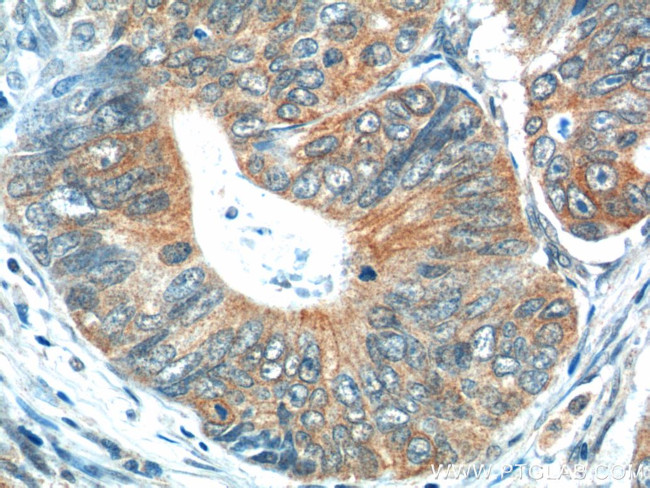 Calcipressin 1 Antibody in Immunohistochemistry (Paraffin) (IHC (P))