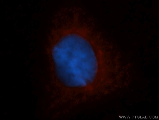 DHODH Antibody in Immunocytochemistry (ICC/IF)