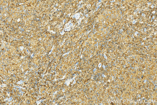 BASP1 Antibody in Immunohistochemistry (Paraffin) (IHC (P))