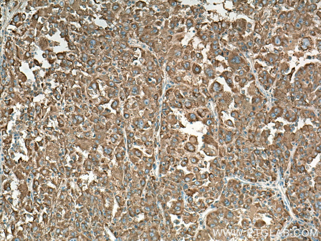 NARS Antibody in Immunohistochemistry (Paraffin) (IHC (P))