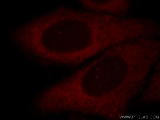 Aldolase C Antibody in Immunocytochemistry (ICC/IF)