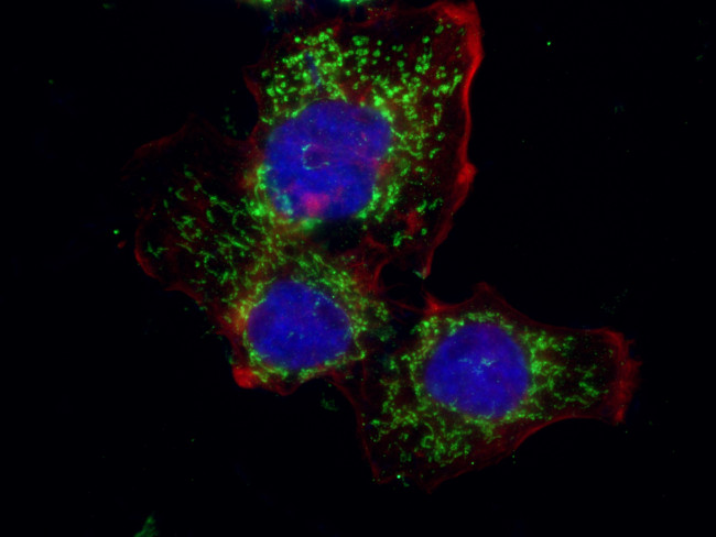 PCK2 Antibody in Immunocytochemistry (ICC/IF)
