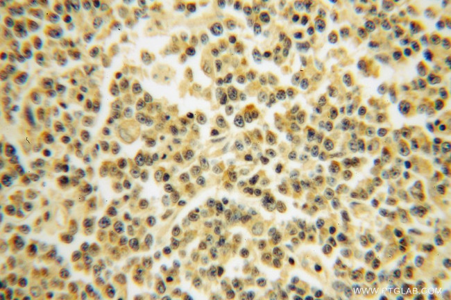 RPS10 Antibody in Immunohistochemistry (Paraffin) (IHC (P))