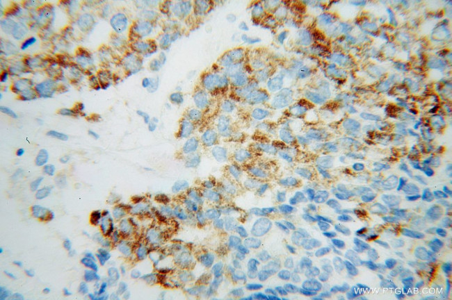 PECR Antibody in Immunohistochemistry (Paraffin) (IHC (P))