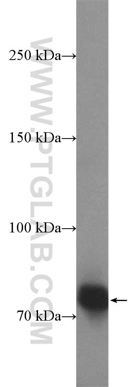 HKR1 Antibody in Western Blot (WB)