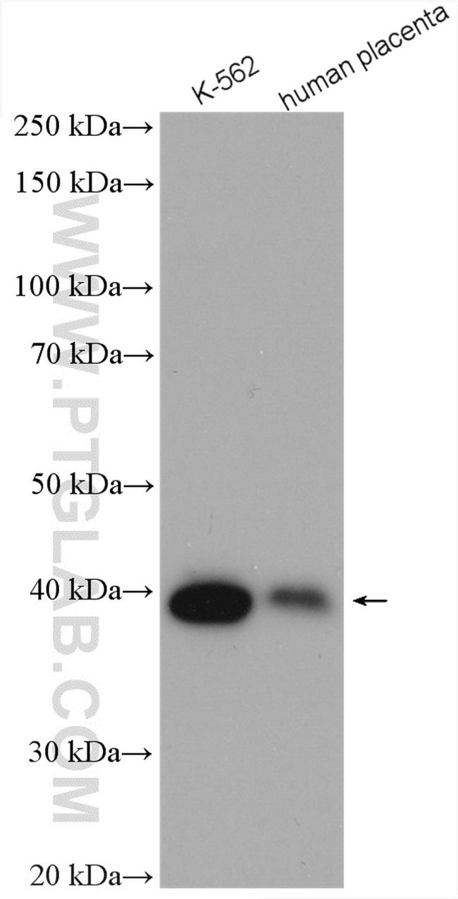 SERPINB9 Antibody in Western Blot (WB)