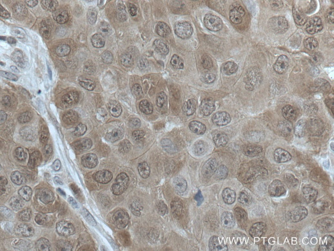 HN1 Antibody in Immunohistochemistry (Paraffin) (IHC (P))