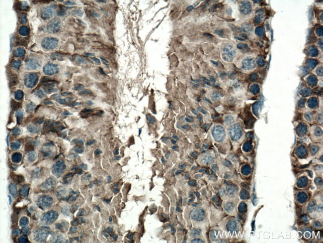 DDOST Antibody in Immunohistochemistry (Paraffin) (IHC (P))