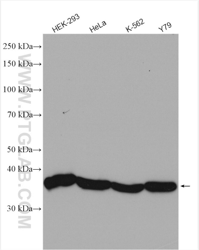 NTHL1 Antibody in Western Blot (WB)