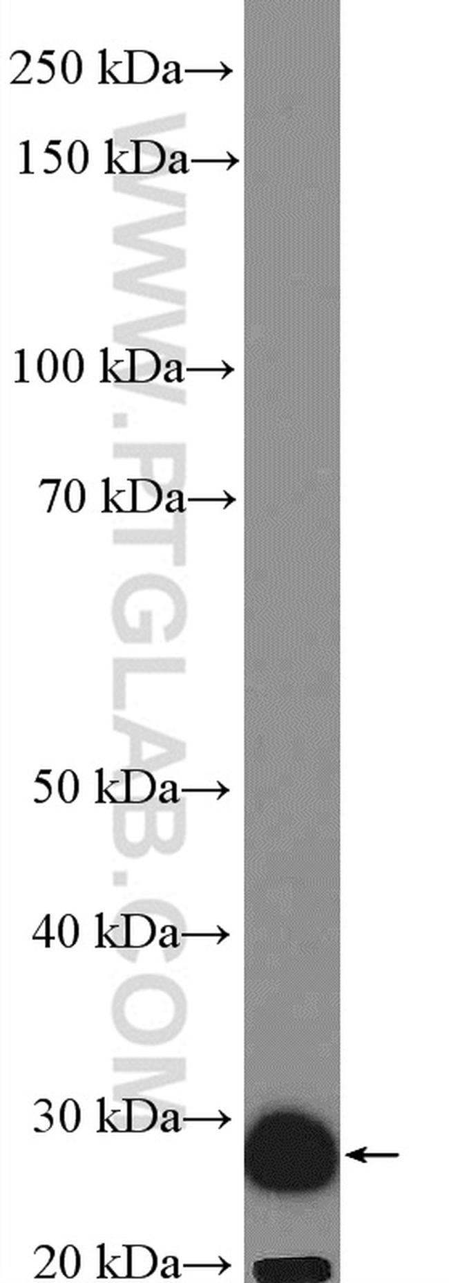 SCGN Antibody in Western Blot (WB)