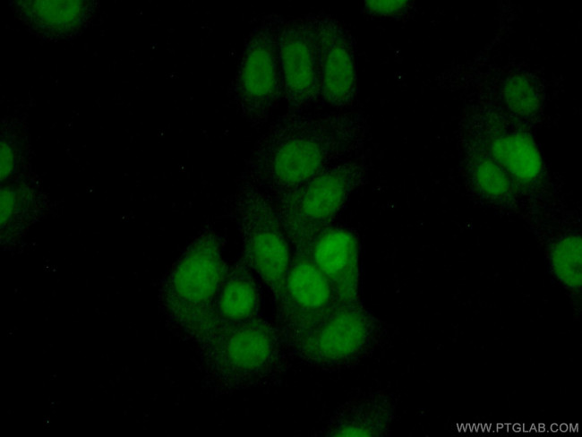 THUMPD1 Antibody in Immunocytochemistry (ICC/IF)