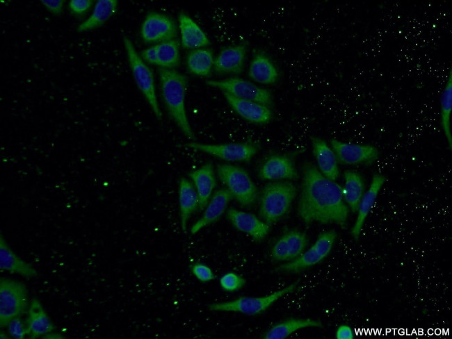CNDP2 Antibody in Immunocytochemistry (ICC/IF)