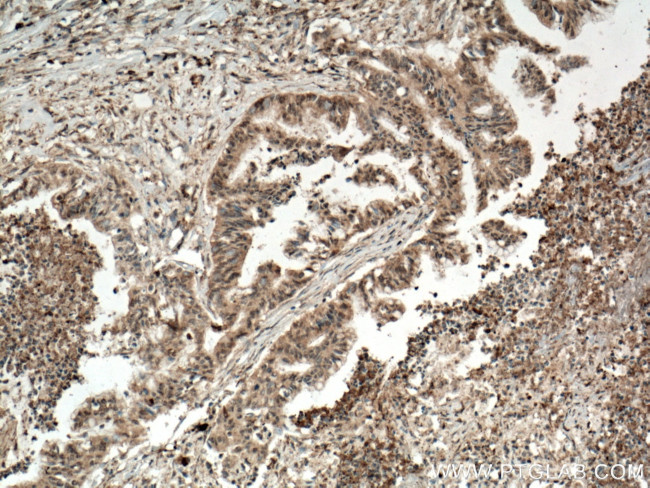 ANAPC5 Antibody in Immunohistochemistry (Paraffin) (IHC (P))