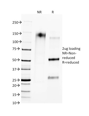 CTLA4/CD152 (Negative Regulator of T-Cells) Antibody in SDS-PAGE (SDS-PAGE)
