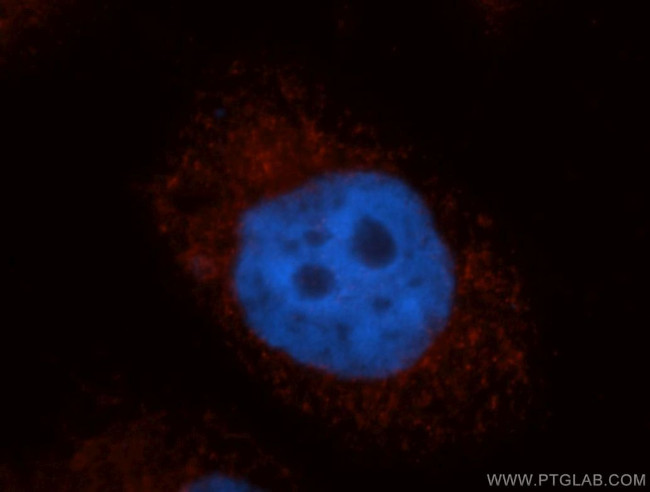 GNPAT Antibody in Immunocytochemistry (ICC/IF)