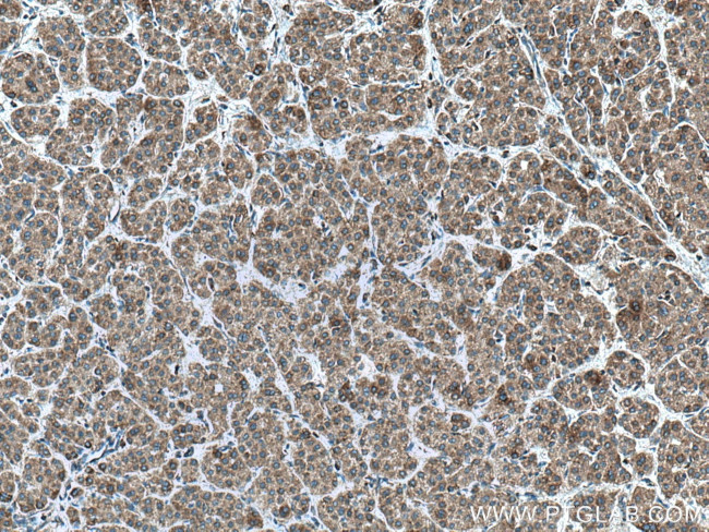 GALNS Antibody in Immunohistochemistry (Paraffin) (IHC (P))