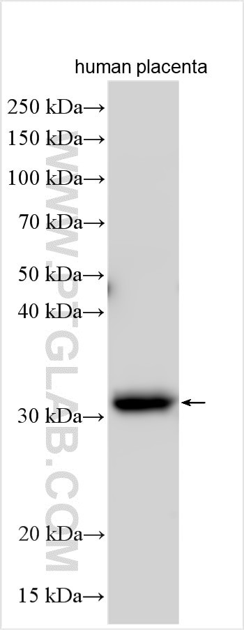 CLIC2 Antibody in Western Blot (WB)