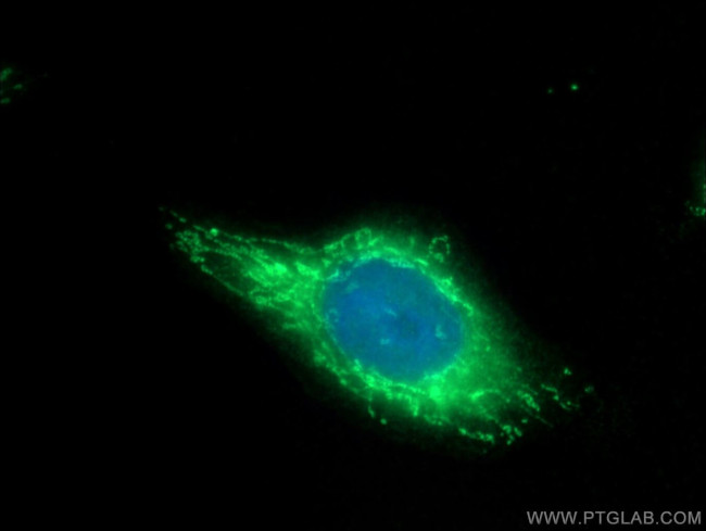 BLMH Antibody in Immunocytochemistry (ICC/IF)