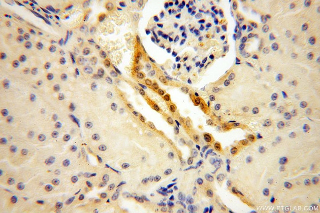 OVCA2 Antibody in Immunohistochemistry (Paraffin) (IHC (P))