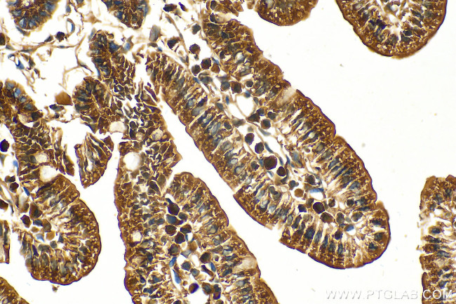 ARIH1 Antibody in Immunohistochemistry (Paraffin) (IHC (P))