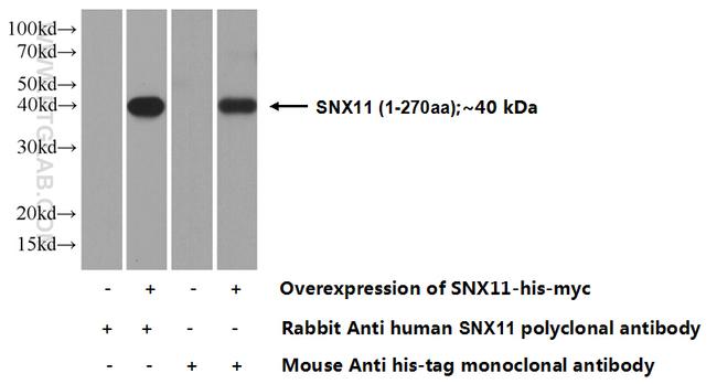 SNX11 Antibody in Western Blot (WB)