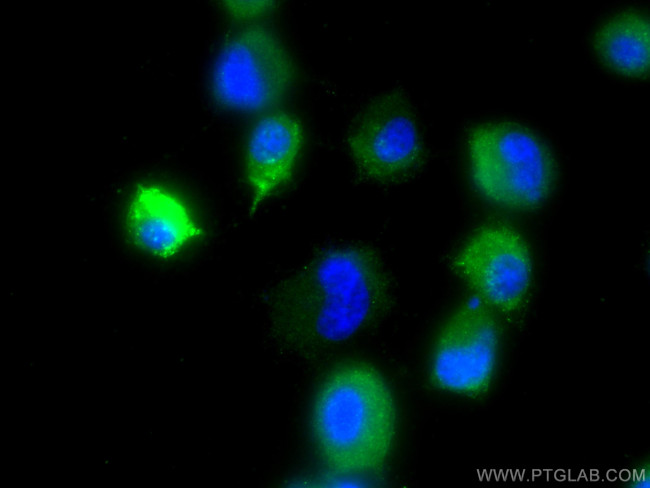 Chromogranin B Antibody in Immunocytochemistry (ICC/IF)