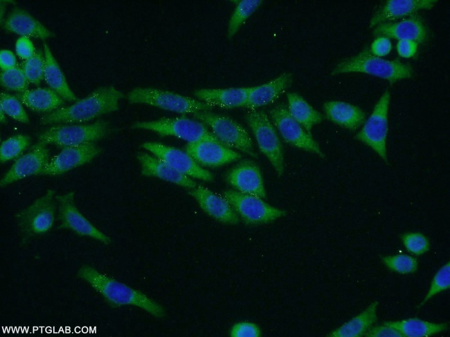 TRMT1 Antibody in Immunocytochemistry (ICC/IF)