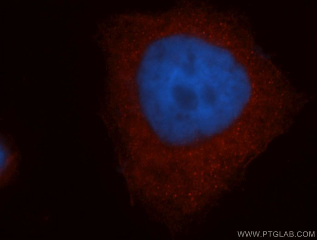 MTMR14 Antibody in Immunocytochemistry (ICC/IF)