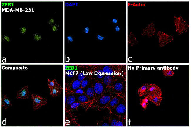 ZEB1 Antibody in Immunocytochemistry (ICC/IF)