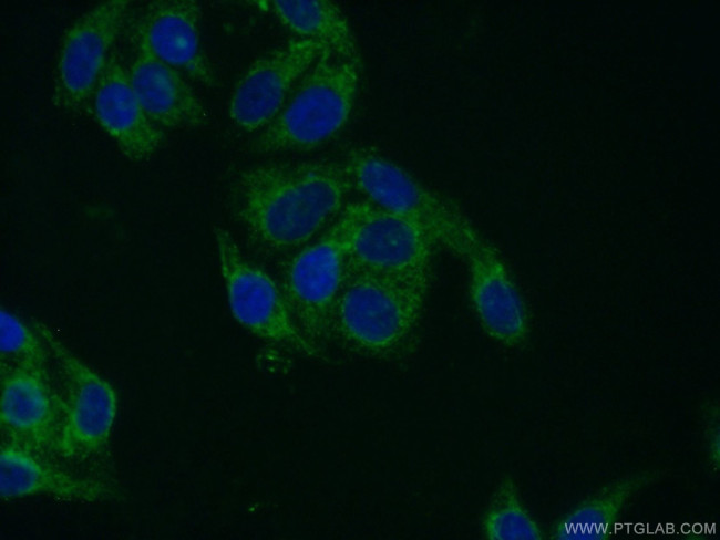 UQCRQ Antibody in Immunocytochemistry (ICC/IF)