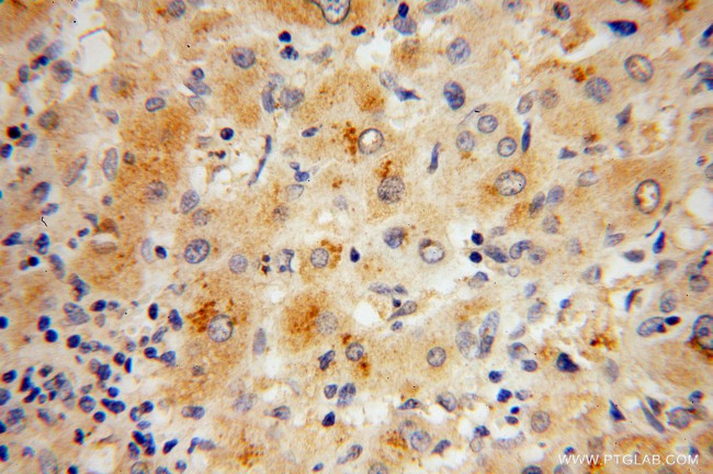 RPL27 Antibody in Immunohistochemistry (Paraffin) (IHC (P))