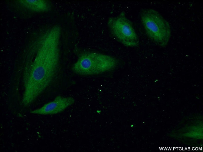 ASMTL Antibody in Immunocytochemistry (ICC/IF)