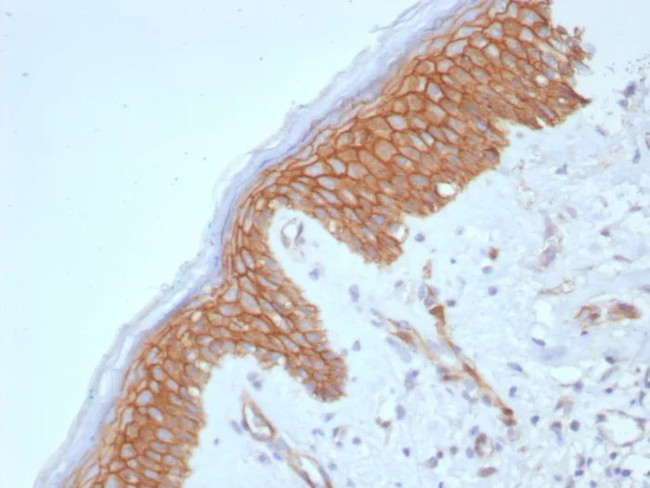 Catenin, beta (CTNNB1) Antibody in Immunohistochemistry (Paraffin) (IHC (P))