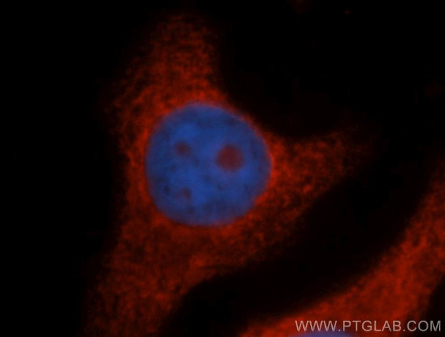 RPL14 Antibody in Immunocytochemistry (ICC/IF)