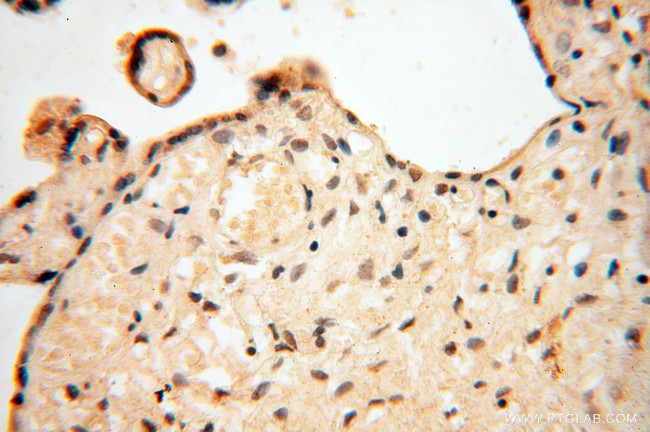 HIRIP3 Antibody in Immunohistochemistry (Paraffin) (IHC (P))