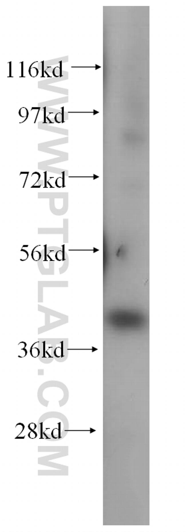 HLA-E Antibody in Western Blot (WB)