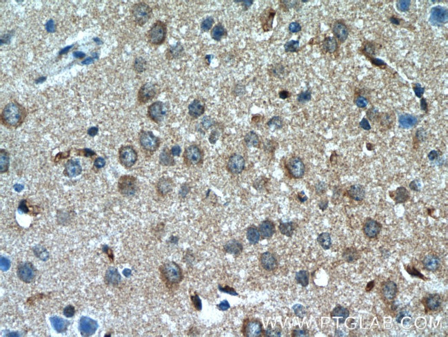 MYO1B Antibody in Immunohistochemistry (Paraffin) (IHC (P))