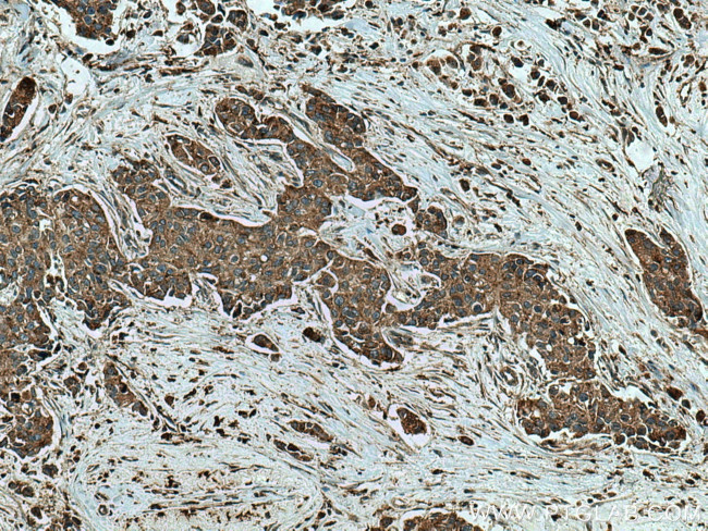 Cathepsin A Antibody in Immunohistochemistry (Paraffin) (IHC (P))