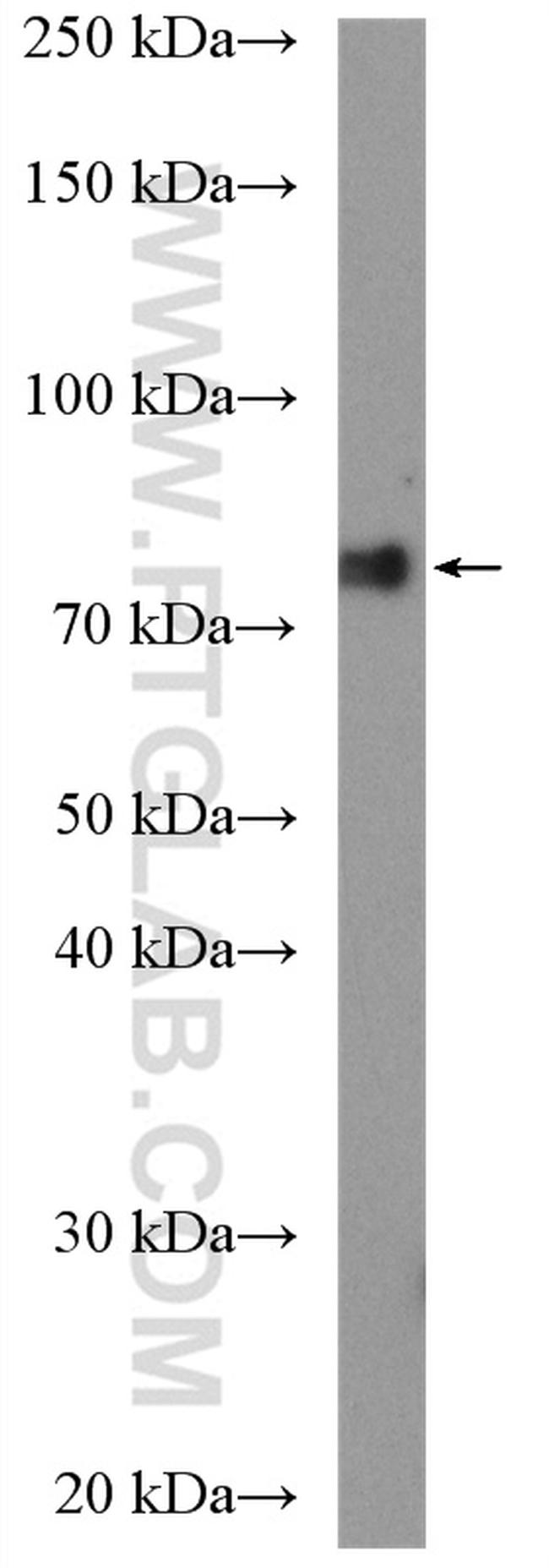 POLR3E Antibody in Western Blot (WB)