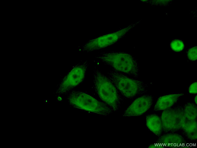 CUTC Antibody in Immunocytochemistry (ICC/IF)